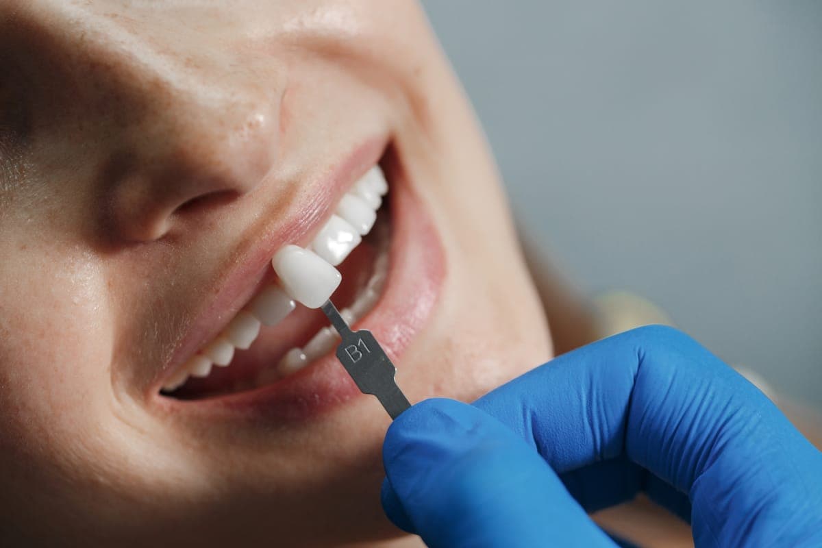Avanços tecnológicos em implantes dentários